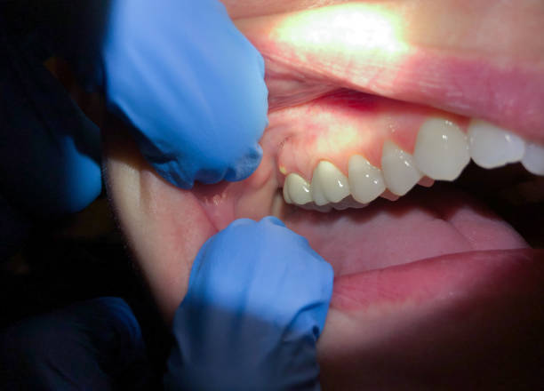 Best Same-Day Emergency Dentist in Kemp Mill, MD
