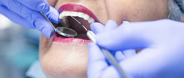 Emergency Dental Fillings